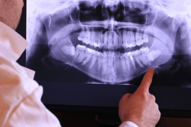 Best Emergency Dental Care for Broken or Chipped Teeth in Lake Winnebago, MO